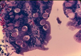 microscopic view of intestinal cells