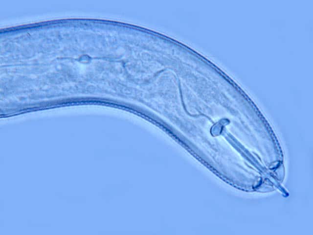 Sugarbeet cyst nematode juvenile