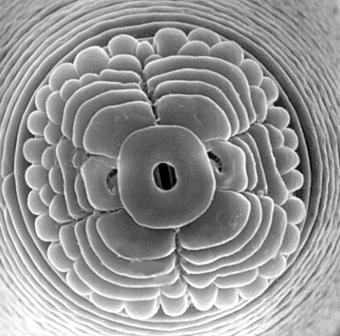 Face view of lance nematode, Hoplolaimus sp. 
